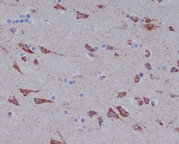 Immunohistochemical analysis of paraffin-embedded human brain, using Glutaminase Antibody.