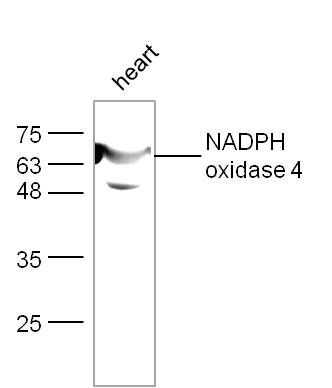 Fig9: Sample:; heart (Mouse) Lysate at 40 ug; Primary: Anti-NADPH oxidase 4 at 1/300 dilution; Secondary: IRDye800CW Goat Anti-Rabbit IgG at 1/20000 dilution; Predicted band size: 64 kD; Observed band size: 64 kD