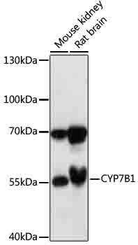 Western blot - CYP7B1 Polyclonal Antibody 