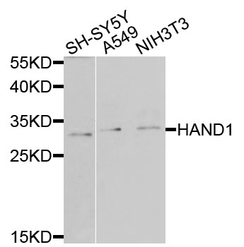 Western blot - HAND1 Polyclonal Antibody 