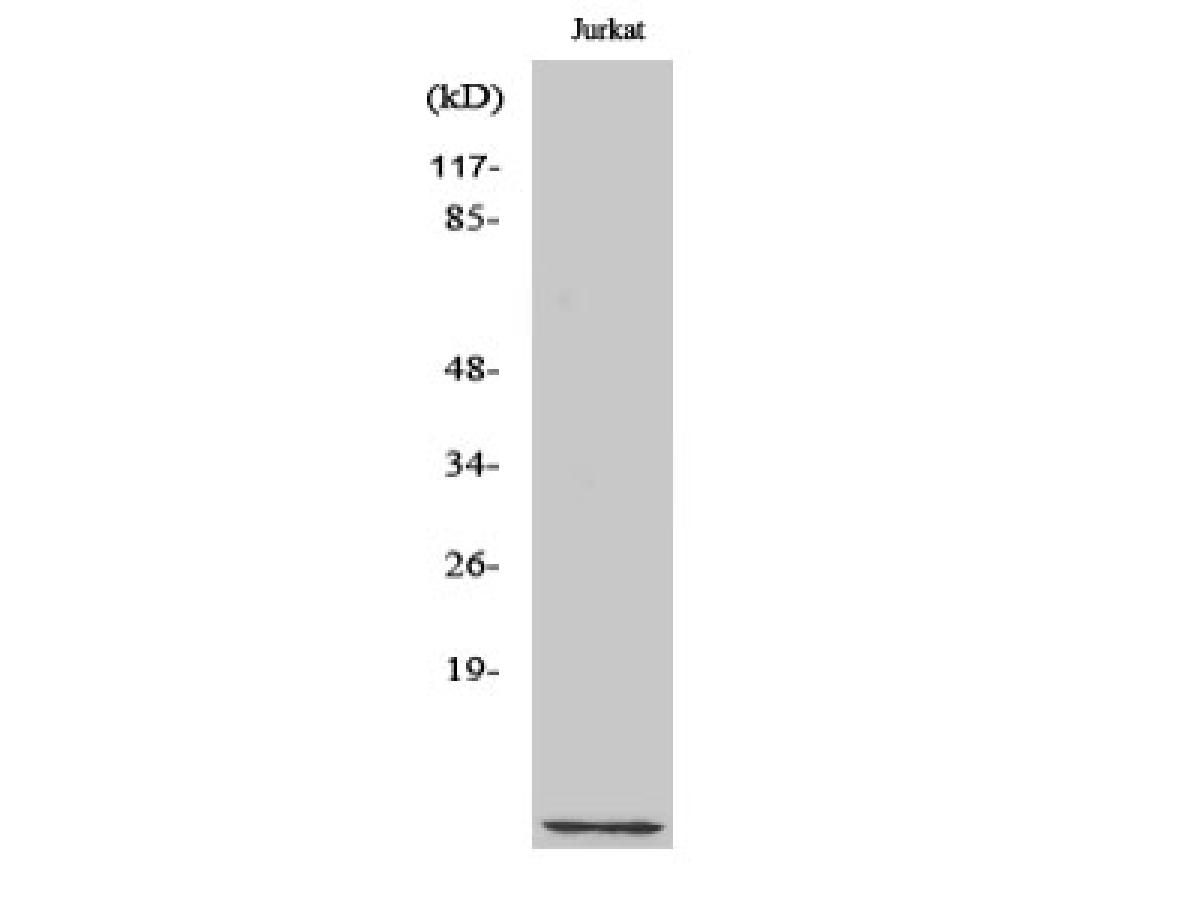 Western blot - CKS1B Polyclonal Antibody 