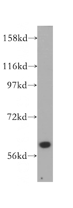 K-562 cells were subjected to SDS PAGE followed by western blot with Catalog No:107683(ABCB10 antibody) at dilution of 1:500