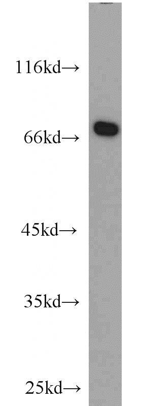 HEK-293 cells were subjected to SDS PAGE followed by western blot with Catalog No:107806(ABCF2 antibody) at dilution of 1:1000