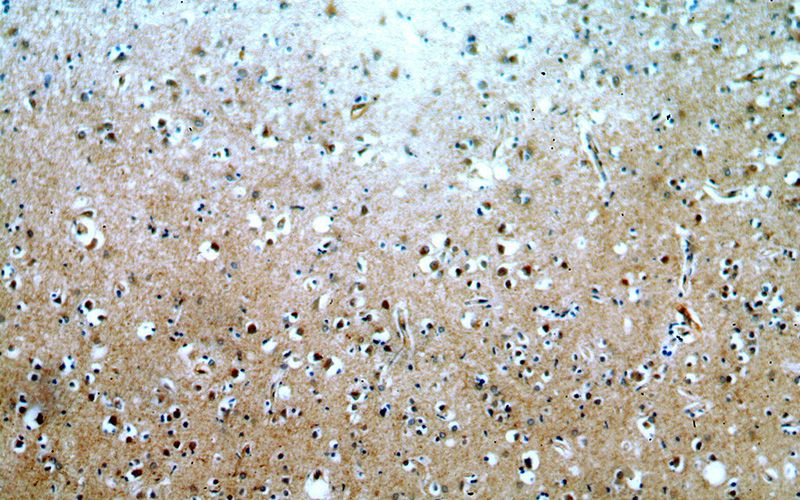 Immunohistochemical of paraffin-embedded human brain using Catalog No:109738(CUEDC2 antibody) at dilution of 1:100 (under 10x lens)
