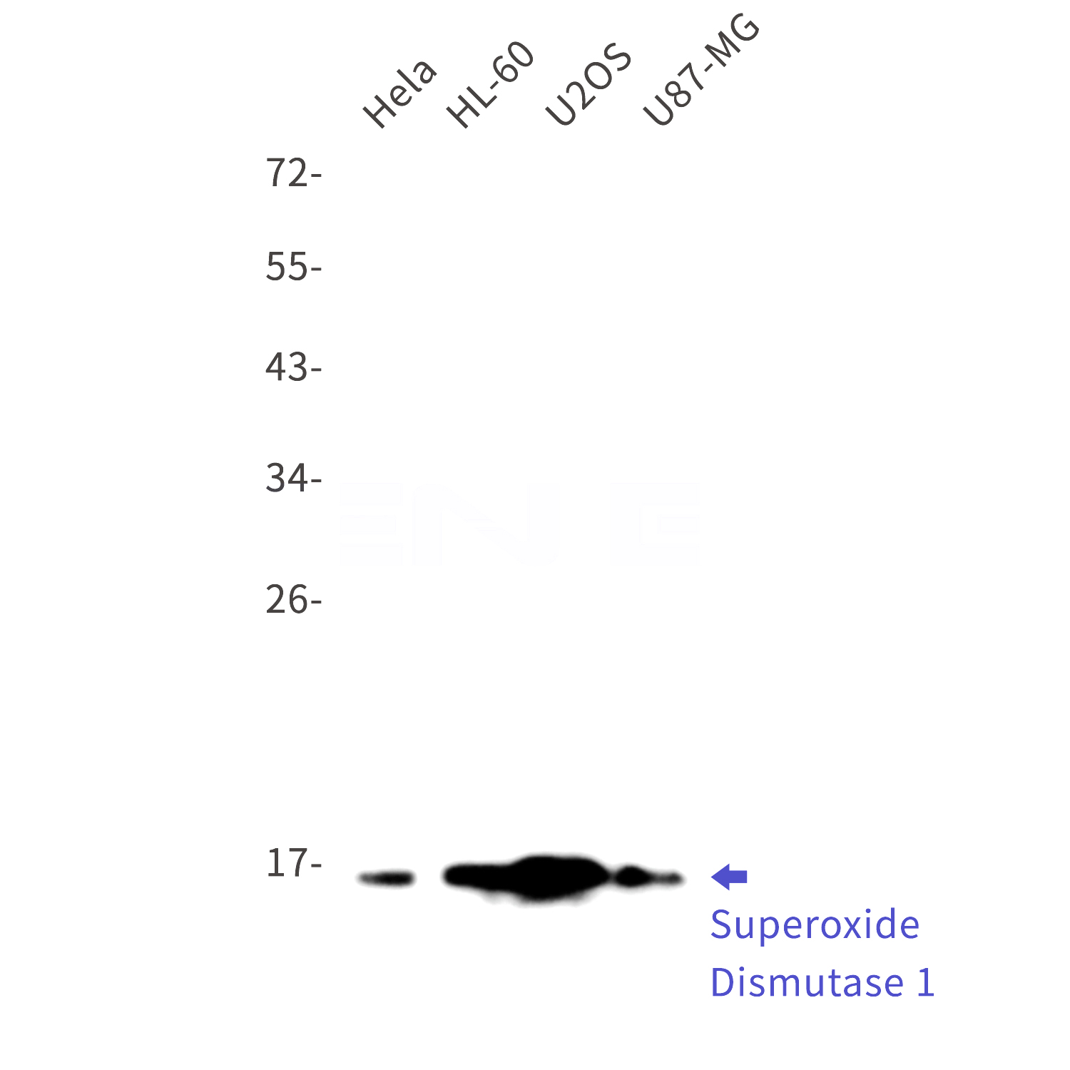 Western blot detection of Superoxide Dismutase 1 in Hela,HL-60,U2OS,U87-MG cell lysates using Superoxide Dismutase 1 Rabbit mAb(1:1000 diluted).Predicted band size:16kDa.Observed band size:16kDa.