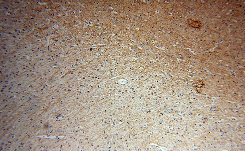 Immunohistochemical of paraffin-embedded human brain using Catalog No:111511(HNRNPR antibody) at dilution of 1:100 (under 10x lens)