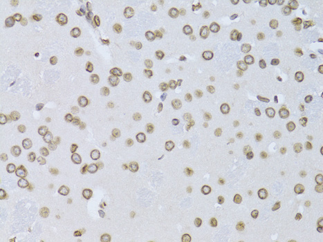 Immunohistochemistry - LMNB2 Polyclonal Antibody 