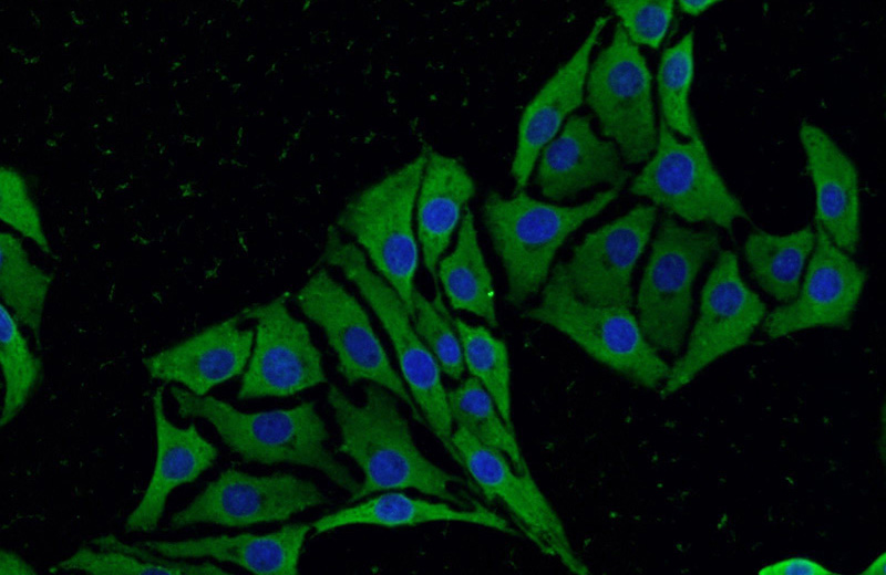Immunofluorescent analysis of SH-SY5Y cells using Catalog No:115005(SCN10A Antibody) at dilution of 1:25 and Alexa Fluor 488-congugated AffiniPure Goat Anti-Rabbit IgG(H+L)