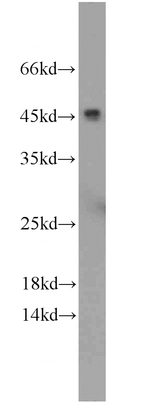 human heart tissue were subjected to SDS PAGE followed by western blot with Catalog No:109198(CFHR3 antibody) at dilution of 1:2000