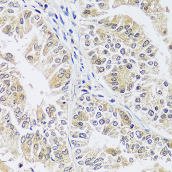 Immunohistochemistry - C12orf10 Polyclonal Antibody 