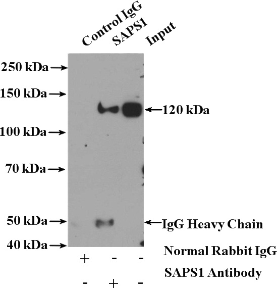 IP Result of anti-SAPS1 (IP:Catalog No:115062, 4ug; Detection:Catalog No:115062 1:1000) with HeLa cells lysate 3200ug.
