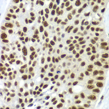 Immunohistochemistry - SF3B2 Polyclonal Antibody 