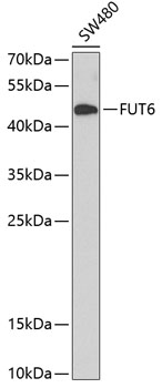 Western blot - FUT6 Polyclonal Antibody 