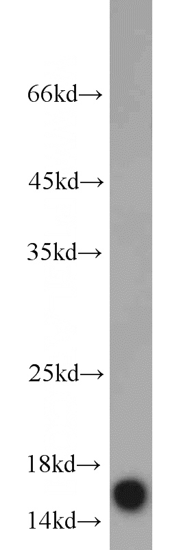 mouse brain tissue were subjected to SDS PAGE followed by western blot with Catalog No:109480(COTL1 antibody) at dilution of 1:1000