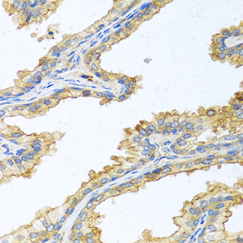 Immunohistochemistry - PRSS1 Polyclonal Antibody 
