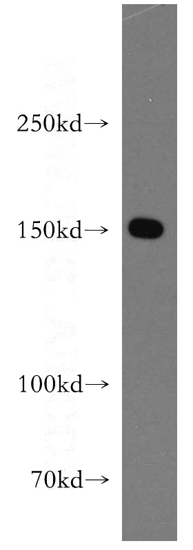 HEK-293 cells were subjected to SDS PAGE followed by western blot with Catalog No:109929(DHX29 antibody) at dilution of 1:500