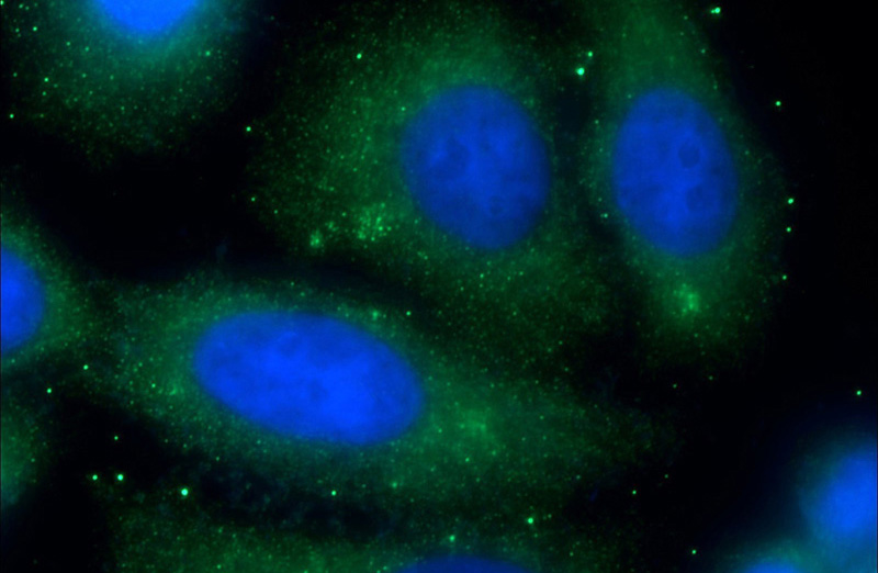 Immunofluorescent analysis of (-20oc Ethanol) fixed HepG2 cells using Catalog No:109548(CREB3L2 Antibody) at dilution of 1:50 and Alexa Fluor 488-congugated AffiniPure Goat Anti-Rabbit IgG(H+L)