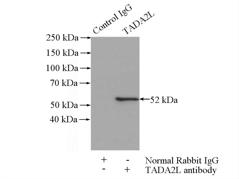 IP Result of anti-TADA2L (IP:Catalog No:115975, 4ug; Detection:Catalog No:115975 1:300) with mouse testis tissue lysate 4000ug.