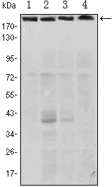 Western blot analysis using RICTOR mouse mAb against Hela (1), PANC-1 (2), MOLT4 (3), and HepG2 (4) cell lysate.