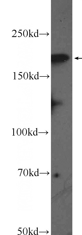 mouse brain tissue were subjected to SDS PAGE followed by western blot with Catalog No:109883(DCC-Specific Antibody) at dilution of 1:600