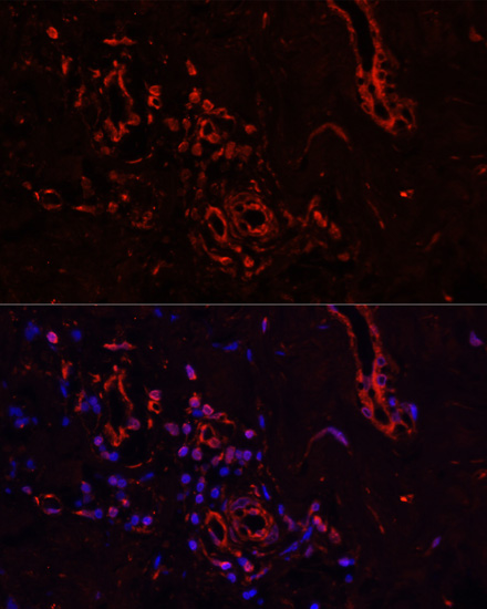 Immunofluorescence - COL1A1 Polyclonal Antibody 