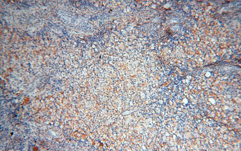 Immunohistochemical of paraffin-embedded human ovary using Catalog No:112525(MFAP4 antibody) at dilution of 1:100 (under 10x lens)