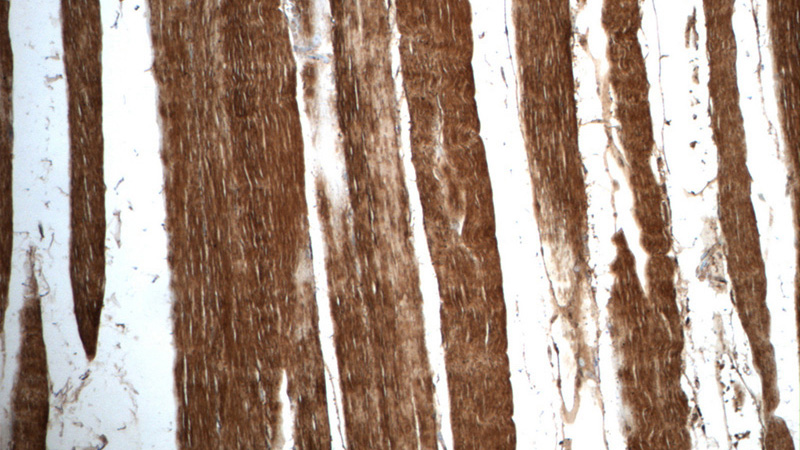 Immunohistochemistry of paraffin-embedded human skeletal muscle tissue slide using Catalog No:109366(CFL2 Antibody) at dilution of 1:50 (under 10x lens)