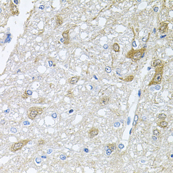 Immunohistochemistry - RAPSN Polyclonal Antibody 