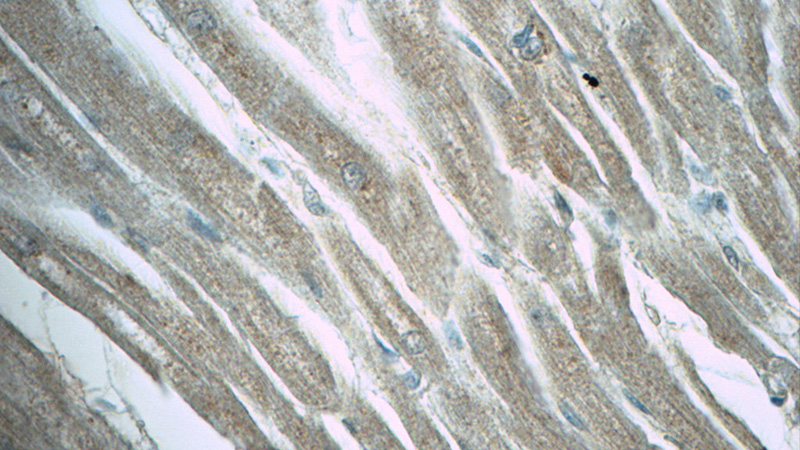 Immunohistochemistry of paraffin-embedded human heart tissue slide using Catalog No:112419(LZTFL1 Antibody) at dilution of 1:50 (under 40x lens)