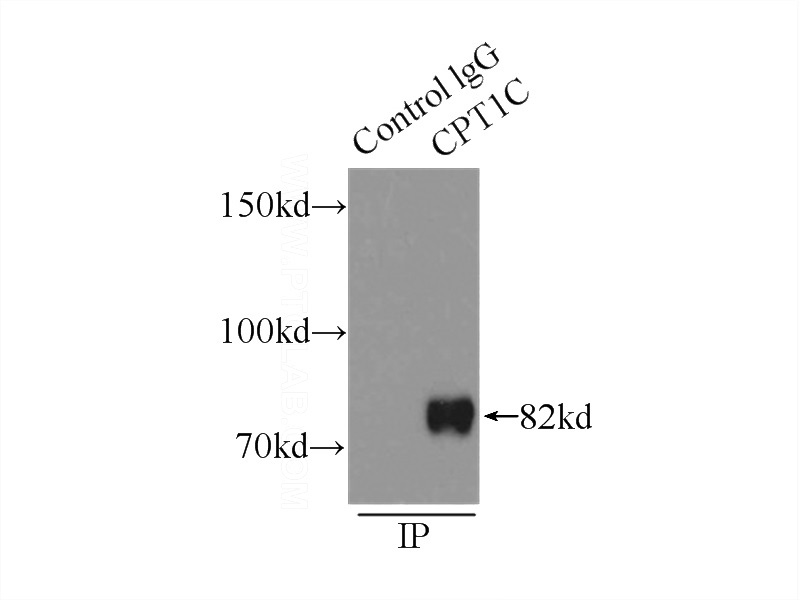 IP Result of anti-CPT1C (IP:Catalog No:109532, 5ug; Detection:Catalog No:109532 1:500) with mouse testis tissue lysate 8000ug.
