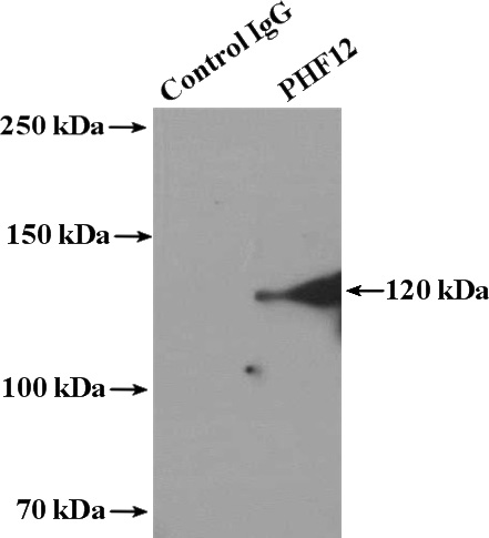 IP Result of anti-PHF12 (IP:Catalog No:113807, 4ug; Detection:Catalog No:113807 1:500) with mouse brain tissue lysate 3600ug.