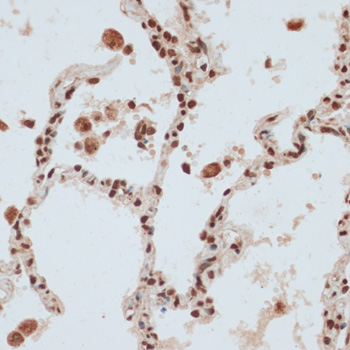 Immunohistochemistry - ZNF574 Polyclonal Antibody 