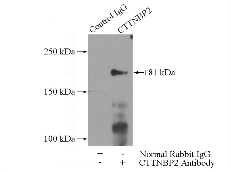 IP Result of anti-CTTNBP2 (IP:Catalog No:109736, 5ug; Detection:Catalog No:109736 1:500) with mouse brain tissue lysate 4000ug.