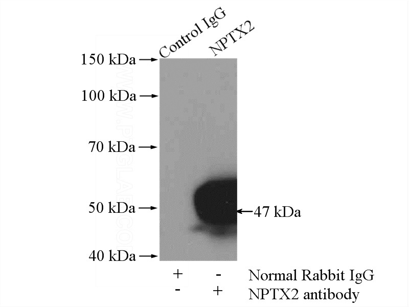 IP Result of anti-NPTX2 (IP:Catalog No:113225, 4ug; Detection:Catalog No:113225 1:600) with mouse brain tissue lysate 4000ug.