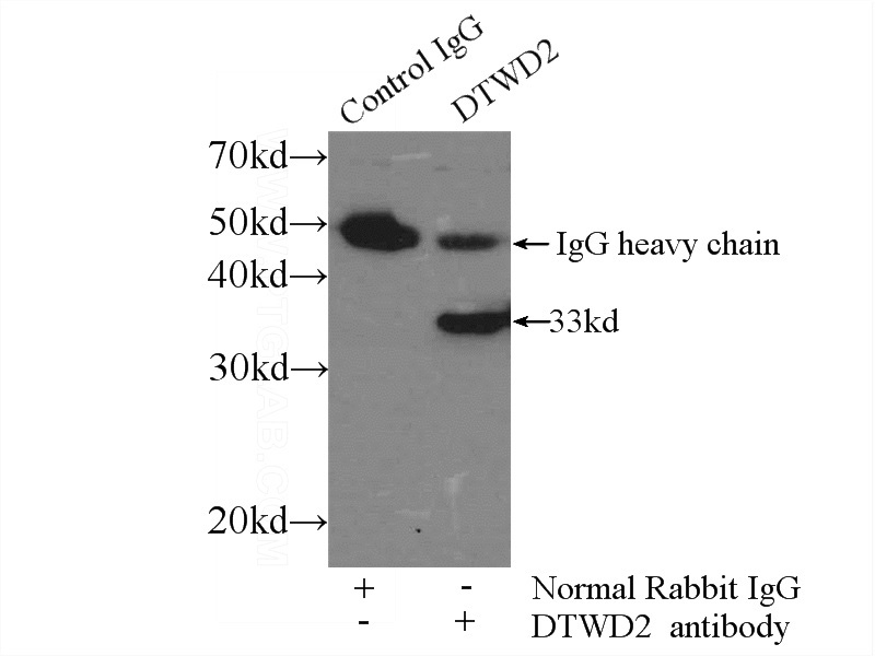 IP Result of anti-DTWD2 (IP:Catalog No:110035, 3ug; Detection:Catalog No:110035 1:300) with COLO 320 cells lysate 2000ug.