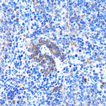 Immunohistochemistry - ACTR2 Polyclonal Antibody 