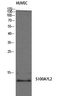 Fig1:; Western Blot analysis of HuvEc cells using S-100A7L2 Polyclonal Antibody