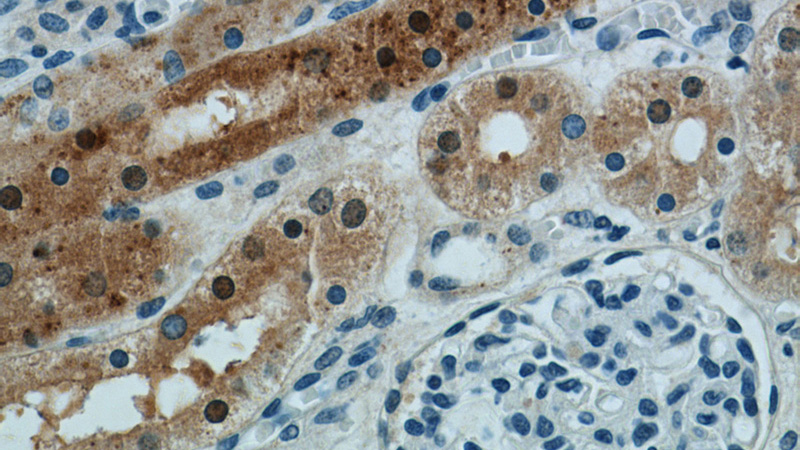 Immunohistochemistry of paraffin-embedded human kidney slide using Catalog No:112904(MUTYH Antibody) at dilution of 1:50
