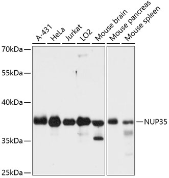 Western blot - NUP35 Polyclonal Antibody 