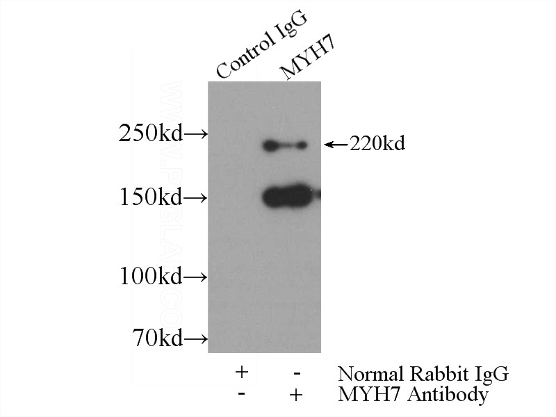 IP Result of anti-MYH7 (IP:Catalog No:112936, 5ug; Detection:Catalog No:112936 1:300) with mouse heart tissue lysate 4000ug.