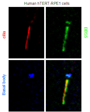 IF result from Dr. Corbit, Kevin. anti-BBS5(Catalog No:108372) marks the ciliary membrane and basal bodies of Human hTERT-RPE1 cells.