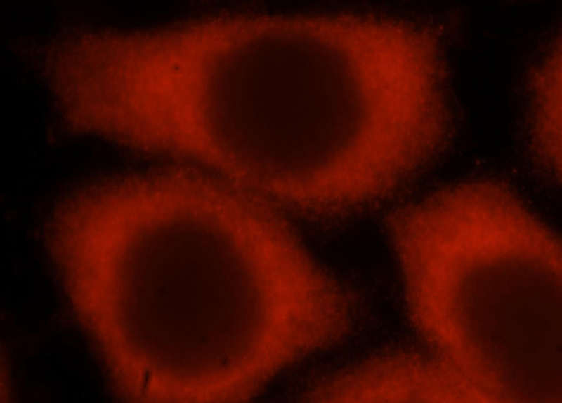Immunofluorescent analysis of Hela cells, using STEAP3 antibody Catalog No:115705 at 1:25 dilution and Rhodamine-labeled goat anti-rabbit IgG (red).