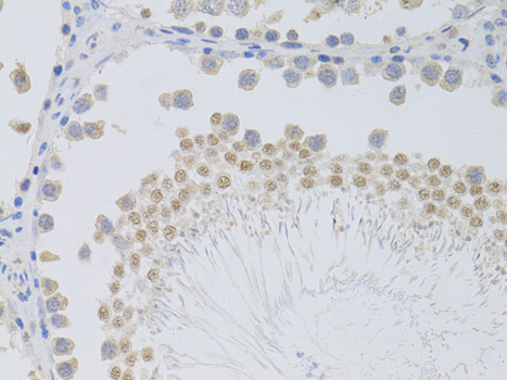 Immunohistochemistry - PHC1 Polyclonal Antibody 