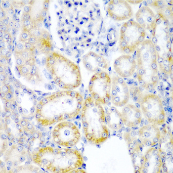 Immunohistochemistry - UPF2 Polyclonal Antibody 