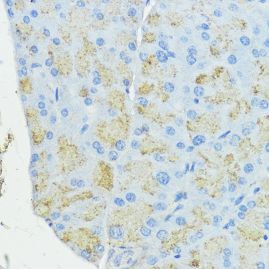 Immunohistochemistry - SOD3 Polyclonal Antibody 