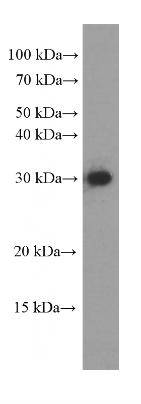human heart tissue were subjected to SDS PAGE followed by western blot with Catalog No:107162(CLPP Antibody) at dilution of 1:1000