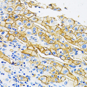 Immunohistochemistry - MCT1 Polyclonal Antibody 