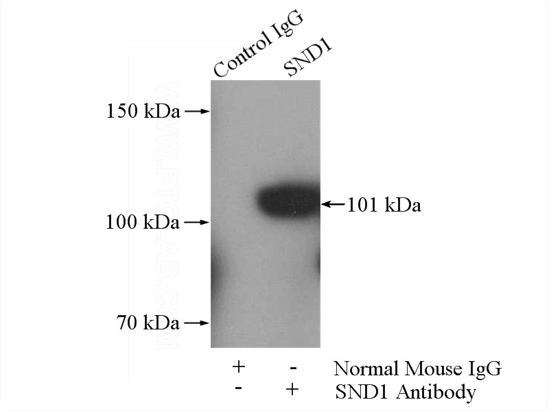 IP Result of anti-SND1 (IP:Catalog No:107598, 5ug; Detection:Catalog No:107598 1:500) with HeLa cells lysate 1400ug.