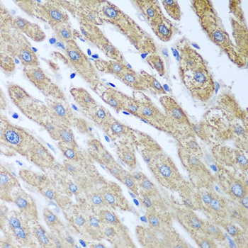 Immunohistochemistry - FUT6 Polyclonal Antibody 