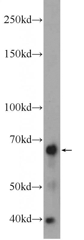 mouse brain tissue were subjected to SDS PAGE followed by western blot with Catalog No:116817(WDR81 Antibody) at dilution of 1:300